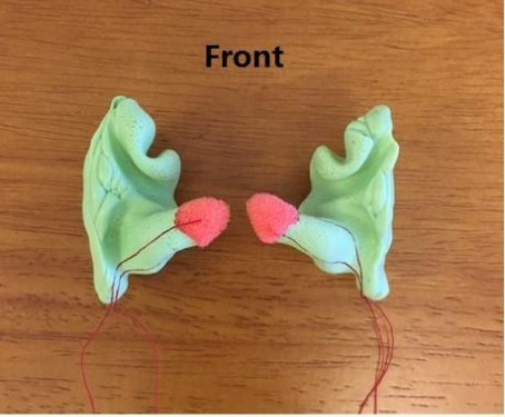 Front view of a well-formed silicone ear impression ready for digital scanning