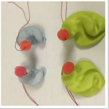 Insufficient ear impression example with missing landmarks