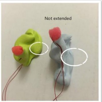 Insufficient ear impression example with canal not extended