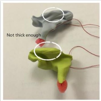 Insufficient ear impression example with thin outer-ear coverage